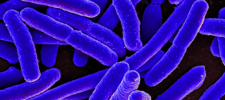 e coli bacteria is a common example of microbial contamination that may occur in pharmacy cleanrooms