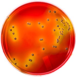 image representing hardy g09 Burkholderia cepacia Selective Agar in detail
